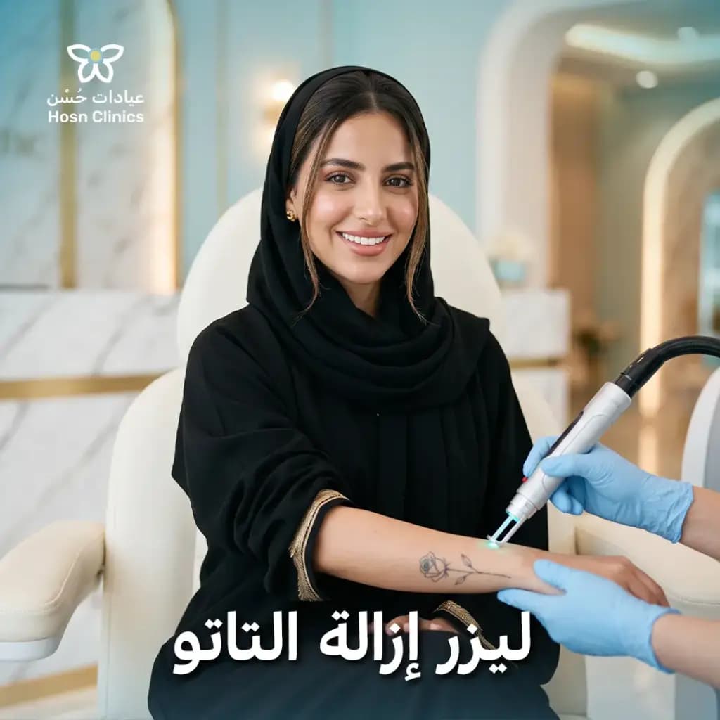 ليزر ازاله التاتو