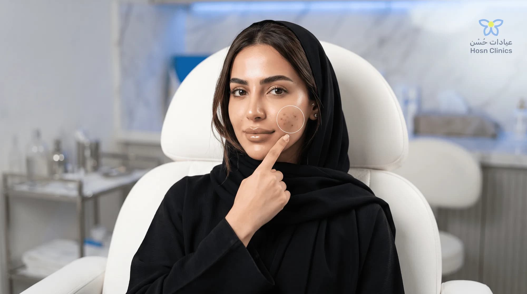 علاج ندبات حب الشباب في الخبر: أفضل التقنيات ونتائج 2026