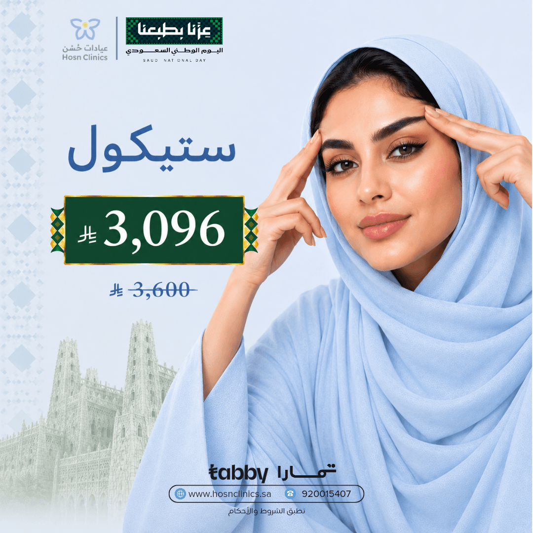 ستيكول