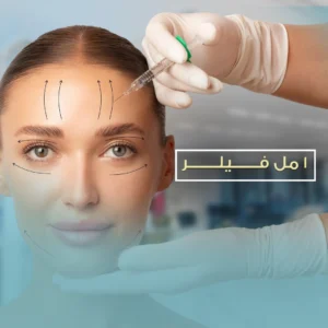 امل فيلر