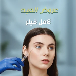 4 مل فيلر