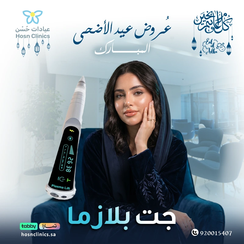 جت بلازما