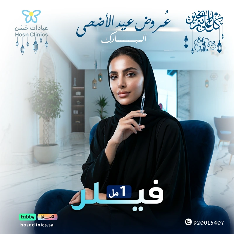 فيلر العيد