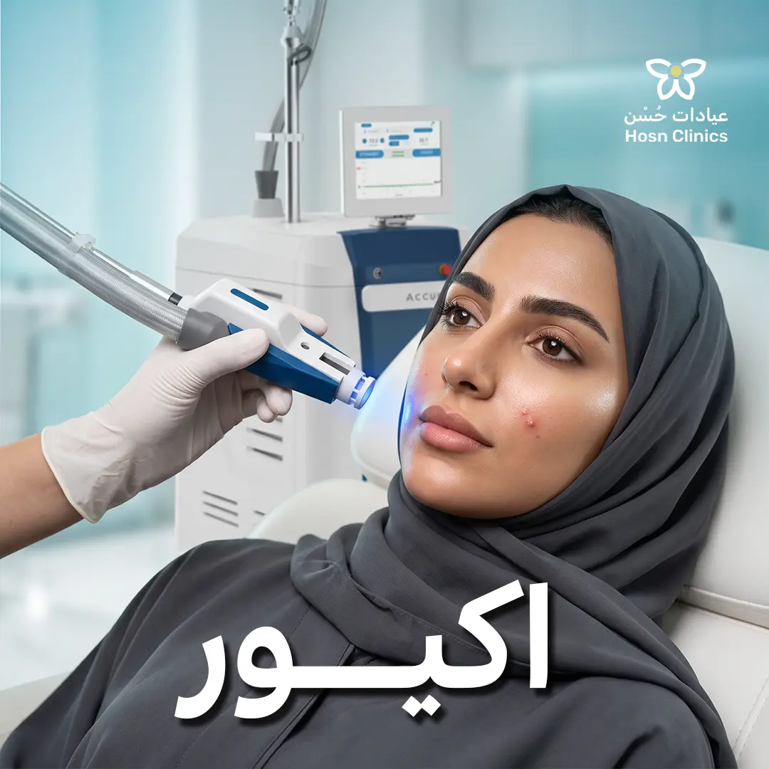 اكيور